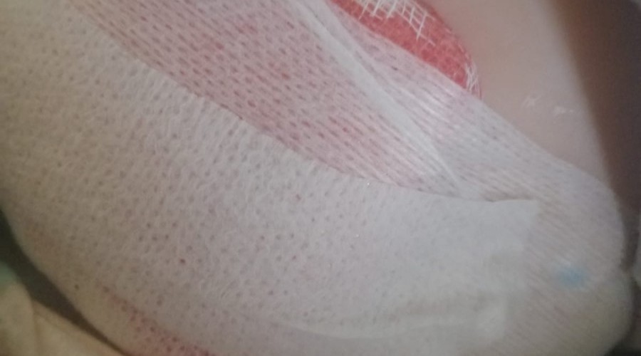 pomoc dla Antosia (9)